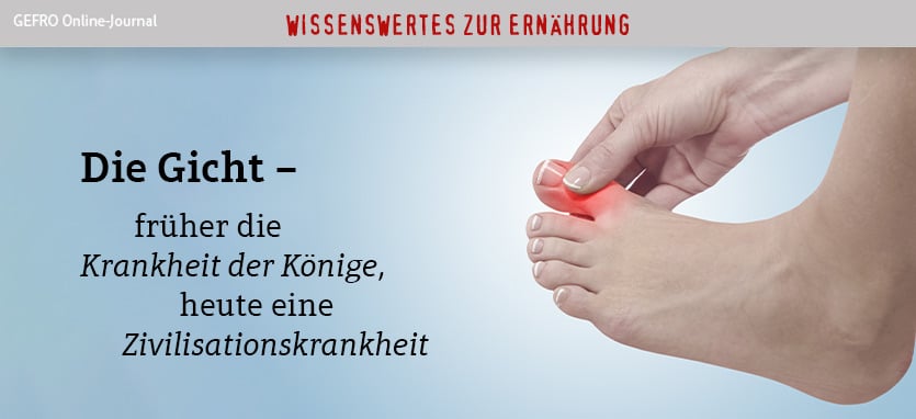 Gicht Alle Wichtigen Infos Gefro